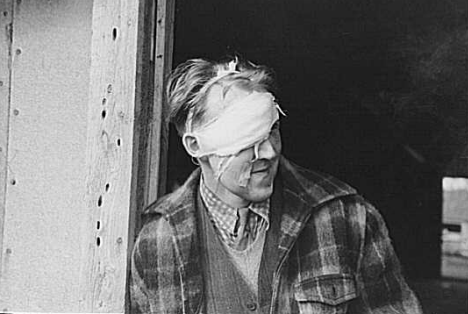 Lumberjack with bandaged head after being beaten up and "rolled" in a saloon on Saturday night in Craigsville Minnesota, 1937